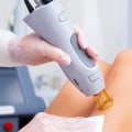 Painless Laser Hair Removal: How to Get Smooth Skin Without the Discomfort