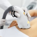 Why Laser Hair Removal Hurts and What to Expect