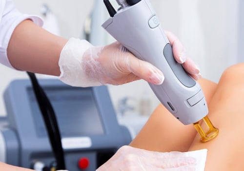 Which Laser Hair Removal is the Least Painful?