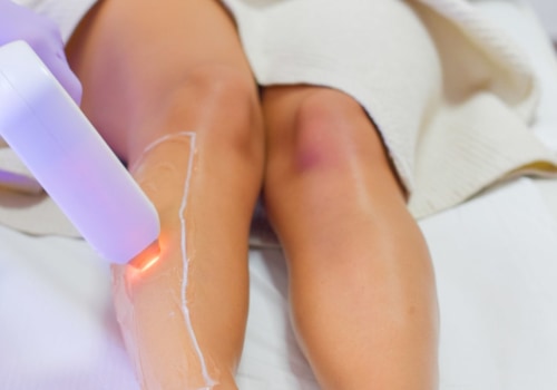Why Laser Hair Removal Doesn't Work on the Face